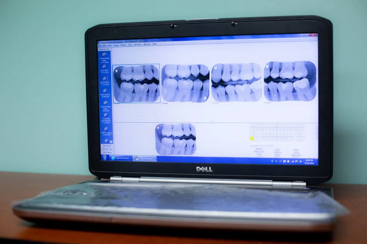 Dental diagnostic equipment